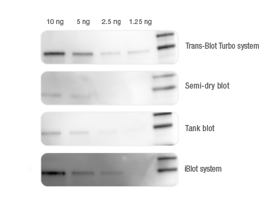 BIO-RAD Trans-Blot®Turbo美國伯樂全能型蛋白轉印系統1704150